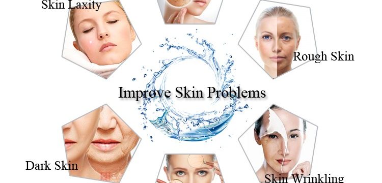 hyaluronic acid in the skin