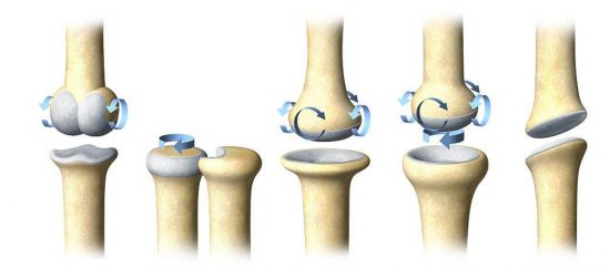 Osteoarthritis treatment