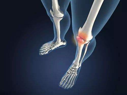 joint synovial fluid