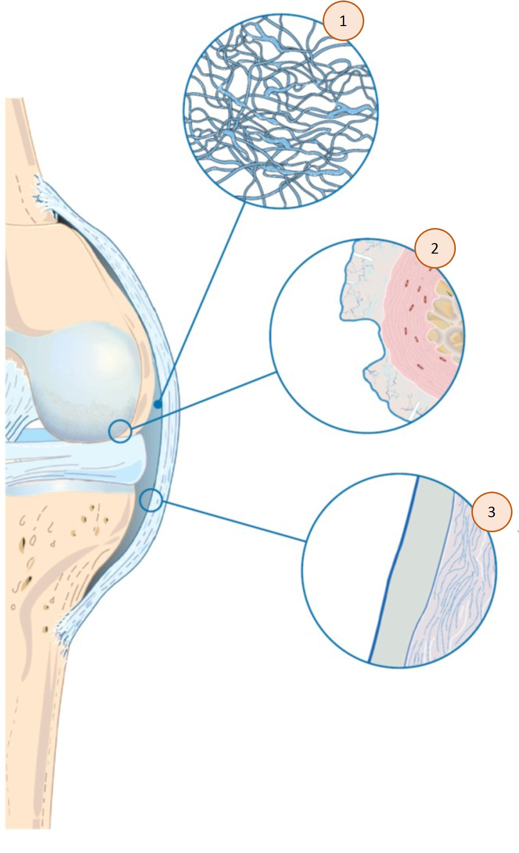 sodium hyaluronate for joint