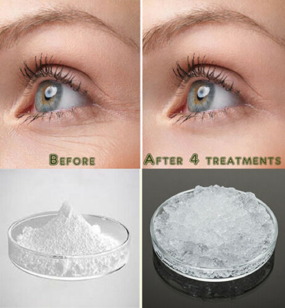 sodium hyaluronate for skin