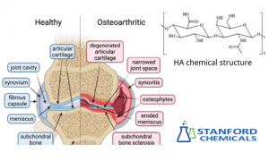 Hyaluronic Acid Injections for joint treatments