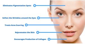 Hyaluronic Acid Injections for face