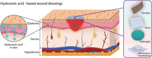 Hyaluronic Acid-Based Dressings