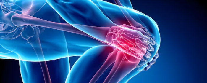 Hyaluronic Acid for Joints
