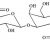 Why Is Sodium Hyaluronate So Important in Skincare