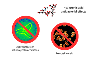 The Role of Hyaluronic Acid in the Treatment of Periodontal Disease