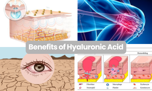 What Does Hyaluronic Acid Do