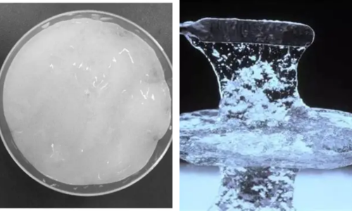 What Does Hyaluronic Acid Gel Do?