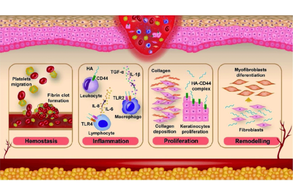 Does Low Molecular Weight Hyaluronic Acid Cause Skin Inflammation